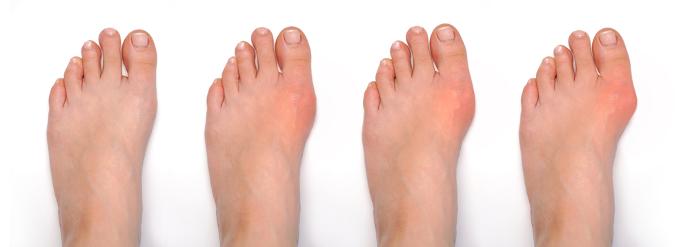 😍SANDALFLEX ⭐⭐⭐⭐⭐ TRANSFORMA TUS PASOS😍DESCUBRE EL COMFORT Y DI ADIOS AL DOLOR🤩