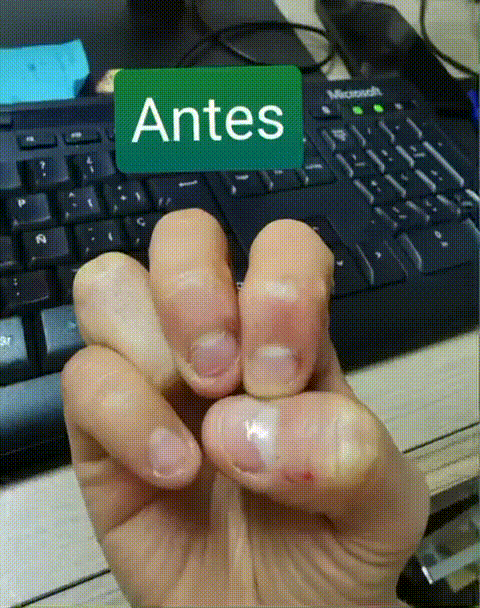 🌟💅VITANAIL🤩:EL PODER DE UNAS UÑAS MAS FUERTES Y SALUDABLES🌟✨