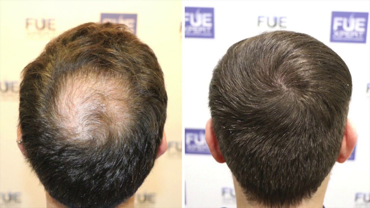 💥FORTIHAIR PRO🤩REVITALIZA TU CABELLO⭐⭐⭐⭐⭐ FUERZA Y VITALIDAD EN CADA HEBRA😍