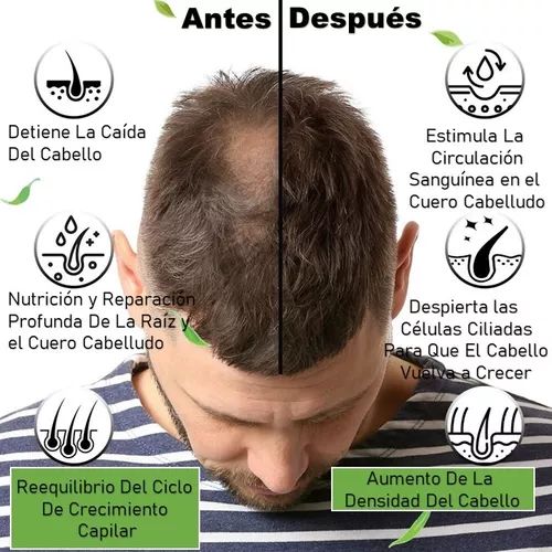 💥FORTIHAIR PRO🤩REVITALIZA TU CABELLO⭐⭐⭐⭐⭐ FUERZA Y VITALIDAD EN CADA HEBRA😍
