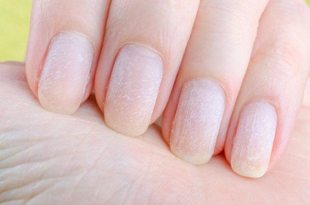 🌟💅VITANAIL🤩:EL PODER DE UNAS UÑAS MAS FUERTES Y SALUDABLES🌟✨